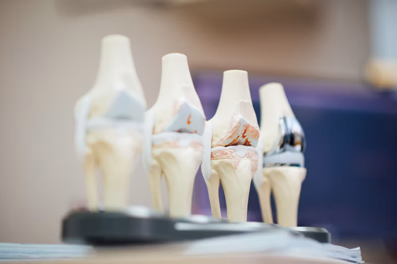 Knee joint preservation consultation and examination